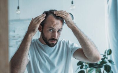 Is your Hair loss from Genes or Something Else?