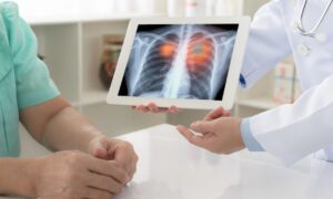 10 Practices Boosting Chronic Lung Disease Risk